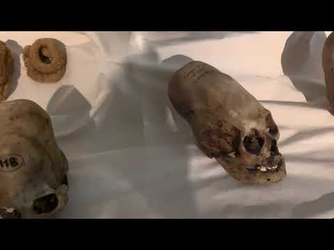 Real Elongated Skulls In The Ica Museum In Peru